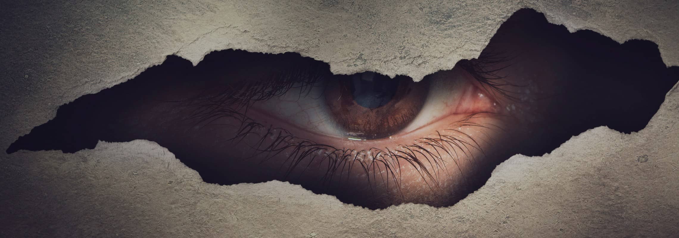 Choc au niveau de l'oeil : comment reconnaître une cataracte traumatique ? | Dr Berthon | Lyon